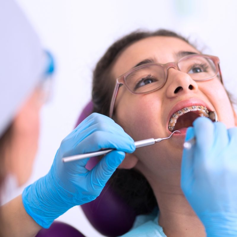 Các sản phẩm hỗ trợ đồng niềng trong cuộc sống! make it easier 2 nieng rang large